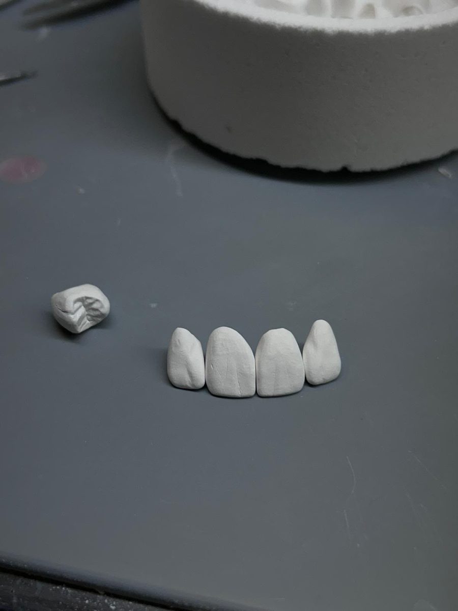 Éléments en zircone préfrittée usinée avant maquillage et cuisson